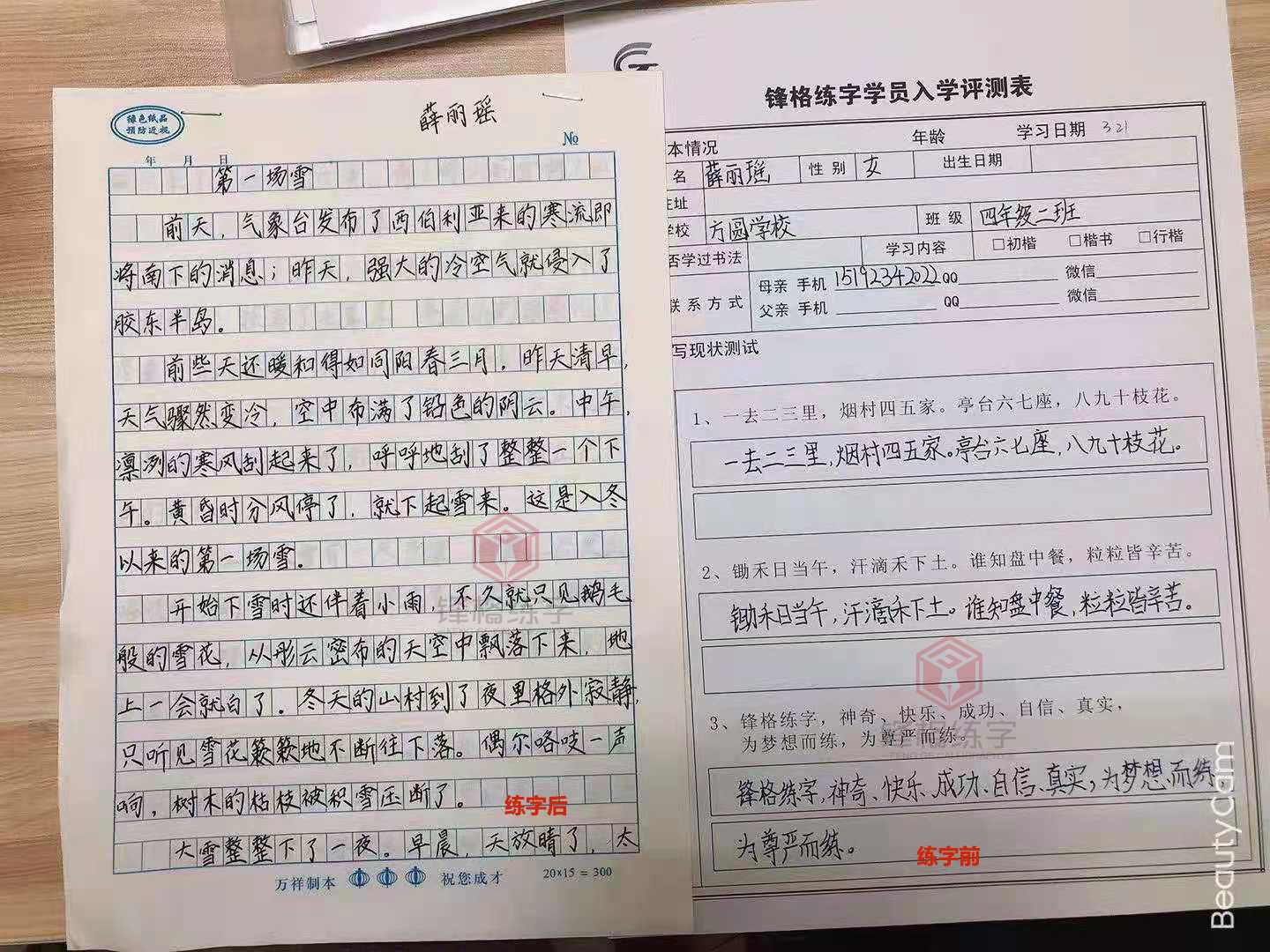 \